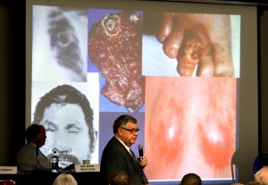 Casey Christie / The Californian Dr. Mike Lancaster, laboratory director at the Kern County Public Health Services Department, speaks on Modern Problems in Valley Fever Diagnosis to Tuesday's crowd at Cal State Bakersfield during the final day of the Valley Fever Symposium in Bakersfield.