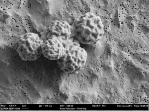  TGEN, a Phoenix-based lab, has captured detailed SEM images of the cocci fungus, which could help answer fundamental questions about valley fever.  Photo: Casey Christie / The Bakersfield Californian